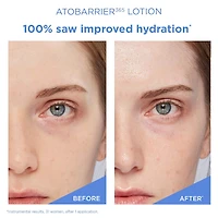 ATOBARRIER365 Lightweight Face Lotion Moisturizer with Ceramides & Niacinamide for Skin Moisture Barrier Repair