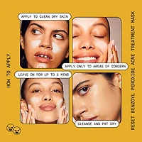 5% Benzoyl Peroxide Acne Treatment Mask with Glycolic Acid