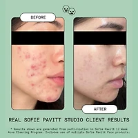 Nice Ice Frozen Cryo Rescue Treatment to Depuff and Calm Skin