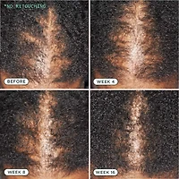 Density Nourishing Actives Scalp Serum for Hair Growth