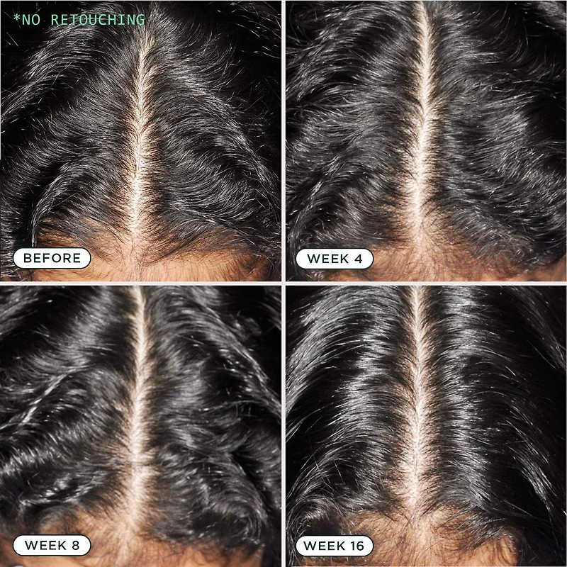 Density Nourishing Actives Scalp Serum for Hair Growth