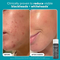 Exfoliation Icons Kit for clear, brighter looking skin