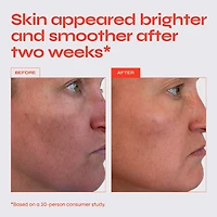 The Buzz Brightening Exfoliating Facial Treatment with AHA & BHA