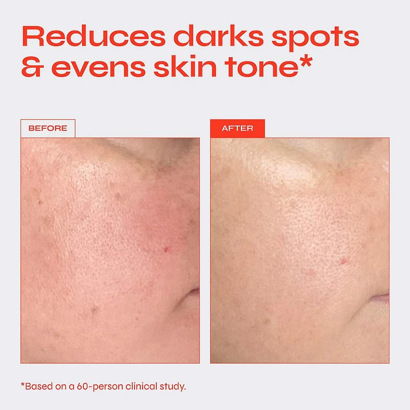 Brighten 5% Niacinamide Serum for Dark Spots & Uneven Texture