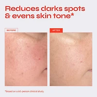 Brighten 5% Niacinamide Serum for Dark Spots & Uneven Texture
