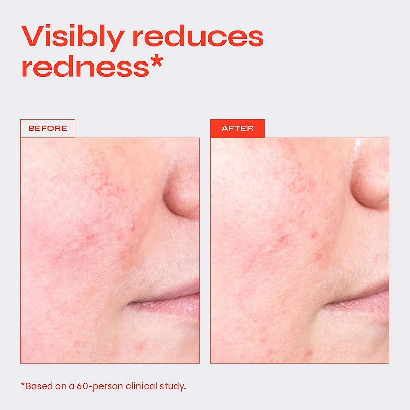 Destress Redness Calming Serum with Vitamin C & Ceramides