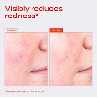 Destress Redness Calming Serum with Vitamin C & Ceramides