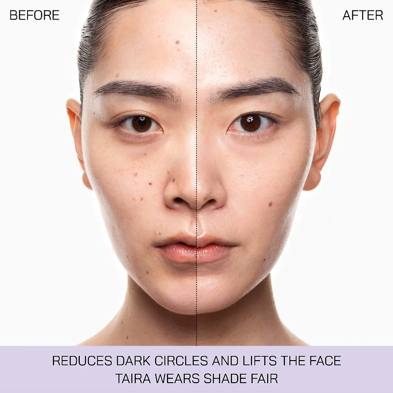5 Point Lift Illuminator