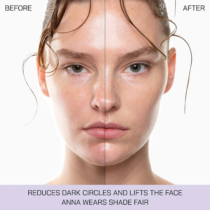 5 Point Lift Illuminator