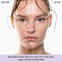 5 Point Lift Illuminator