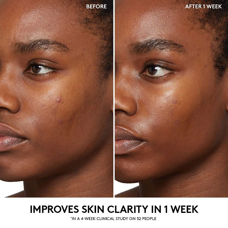 Cherry Dub BHA Toner with Salicylic Acid + Aloe Juice