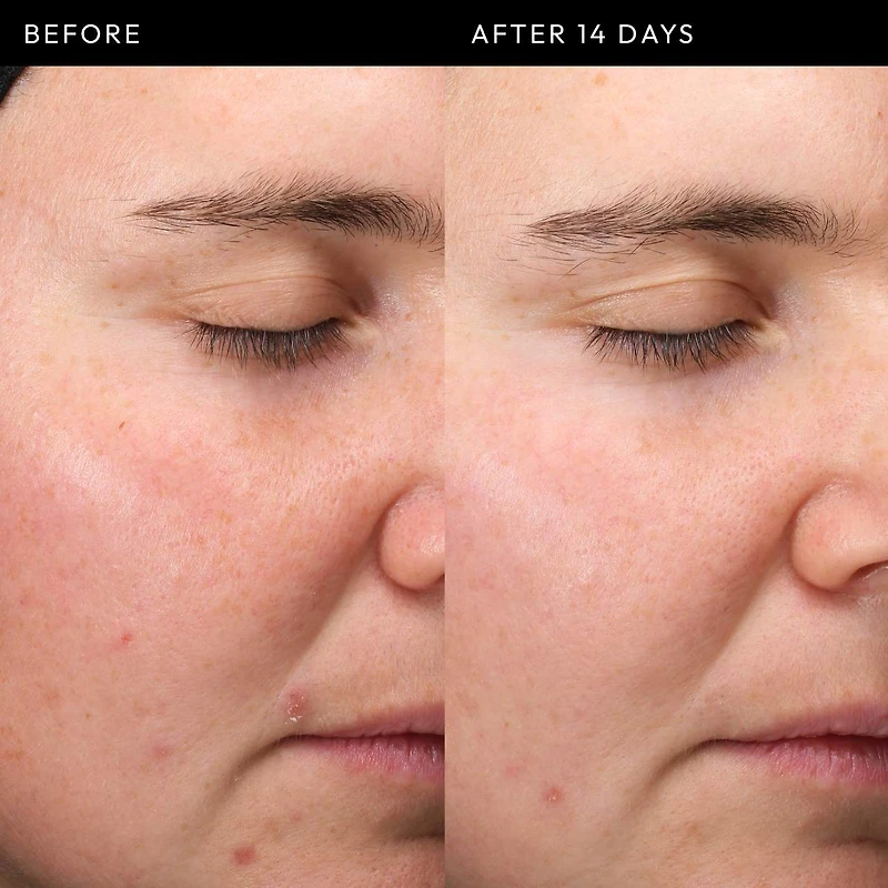 Exosome Hydro-Glow Complex Serum