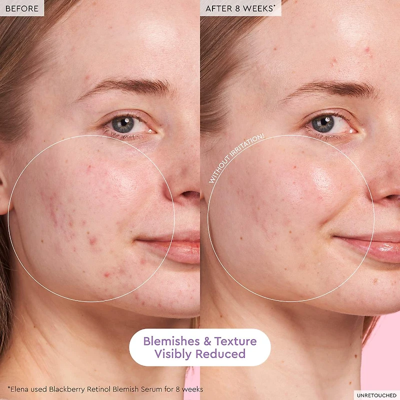 Glass Skin Hydration Kit
