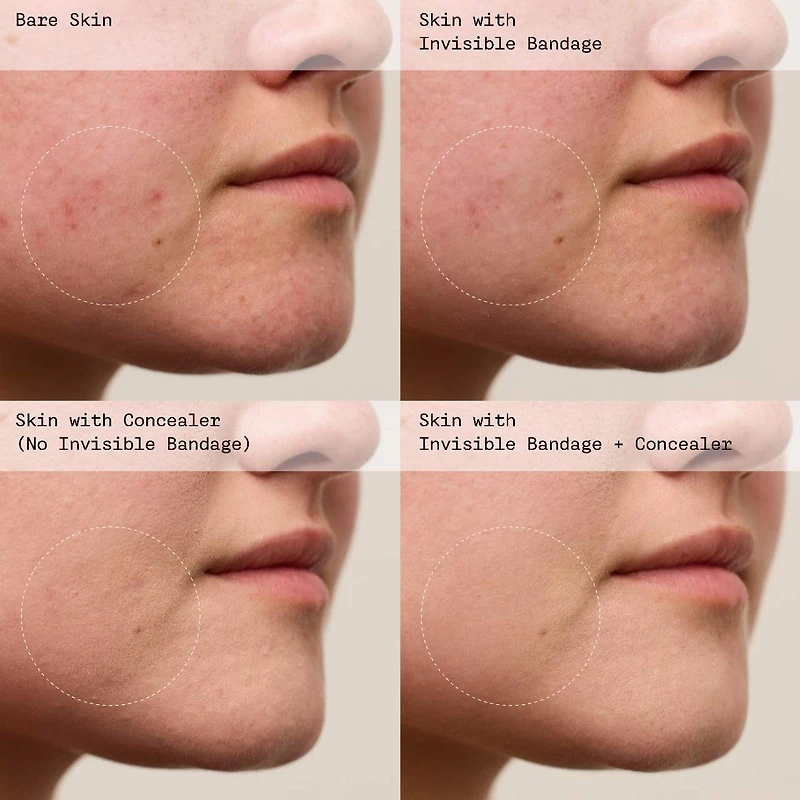 INVISIBLE BANDAGE Protect + Prime Solution Gel with Niacinamide
