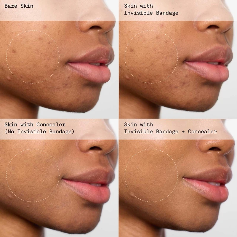 INVISIBLE BANDAGE Protect + Prime Solution Gel with Niacinamide