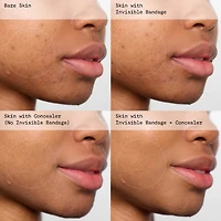 INVISIBLE BANDAGE Protect + Prime Solution Gel with Niacinamide