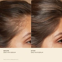 Healthy Hair Starter Set