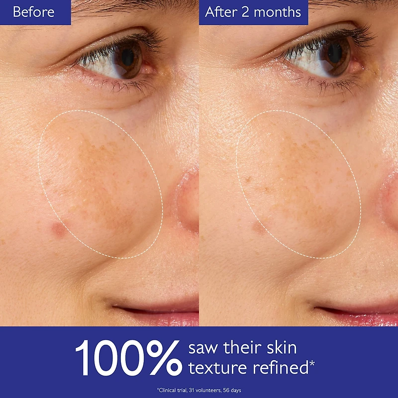 Vinoperfect Brightening Glycolic Essence