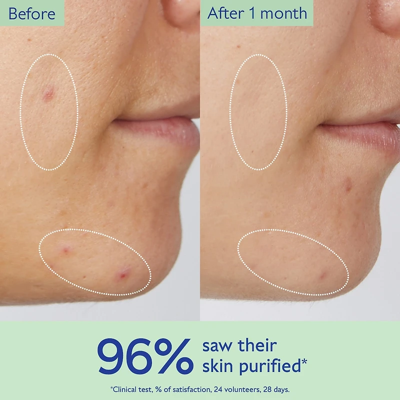 Gel nettoyant purifiant pour les pores Vinopure