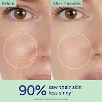 Vinopure Salicylic Acid Pore Minimizing Toner