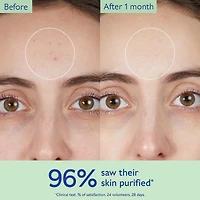 Vinopure Pore Purifying Gel Cleanser