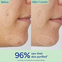 Vinopure Pore Purifying Gel Cleanser