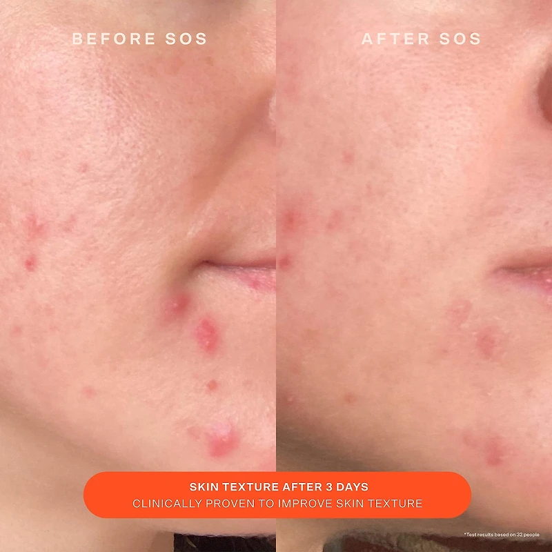 Hydratant réparateur de rougeurs SOS Daily Skin Barrier