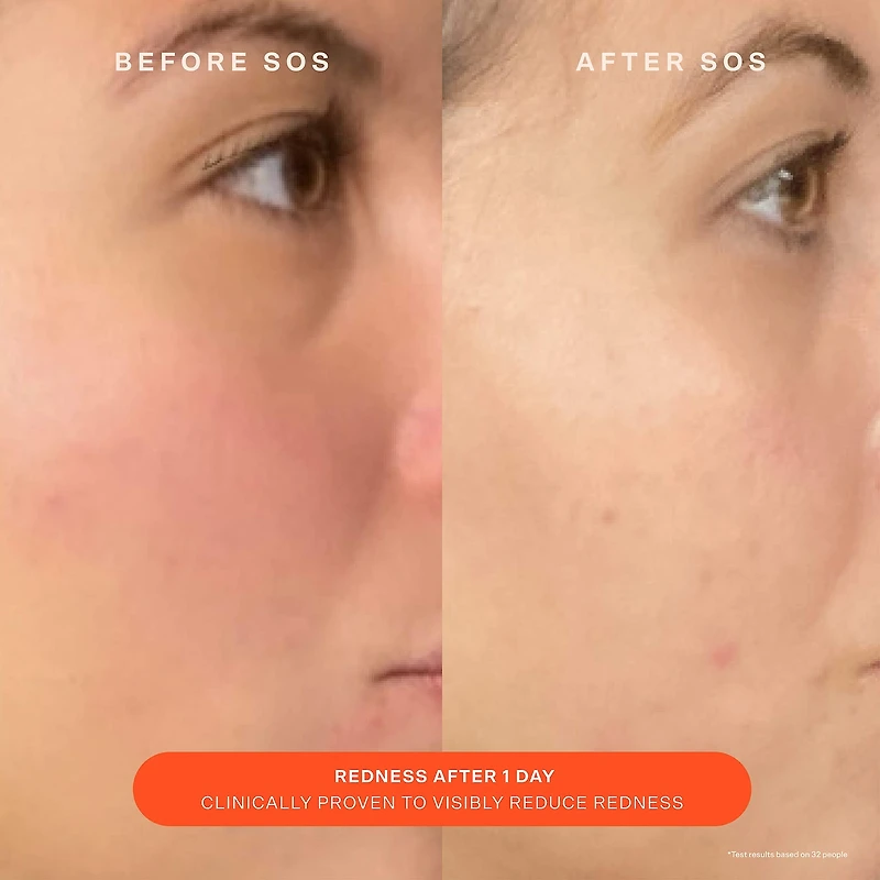 Hydratant réparateur de rougeurs SOS Daily Skin Barrier