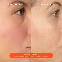SOS Daily Skin Barrier Redness Recovery Moisturizer