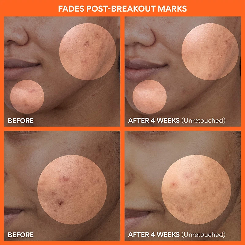 Green Tea Enzyme Vitamin C Brightening + Exfoliating Toner Pads