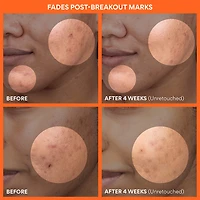 Green Tea Enzyme Vitamin C Brightening + Exfoliating Toner Pads