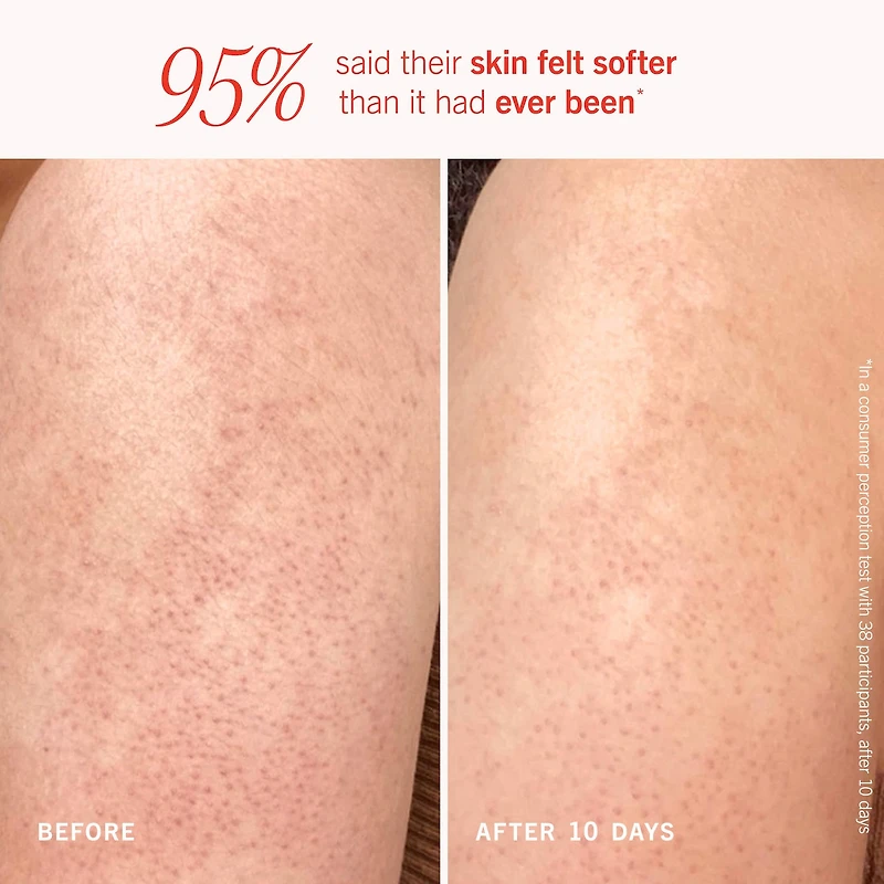 Exfoliant pour le corps KP Bump Eraser avec 10 % d’AHA cibler la kératose pilaire