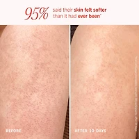 Exfoliant pour le corps KP Bump Eraser avec 10 % d’AHA cibler la kératose pilaire