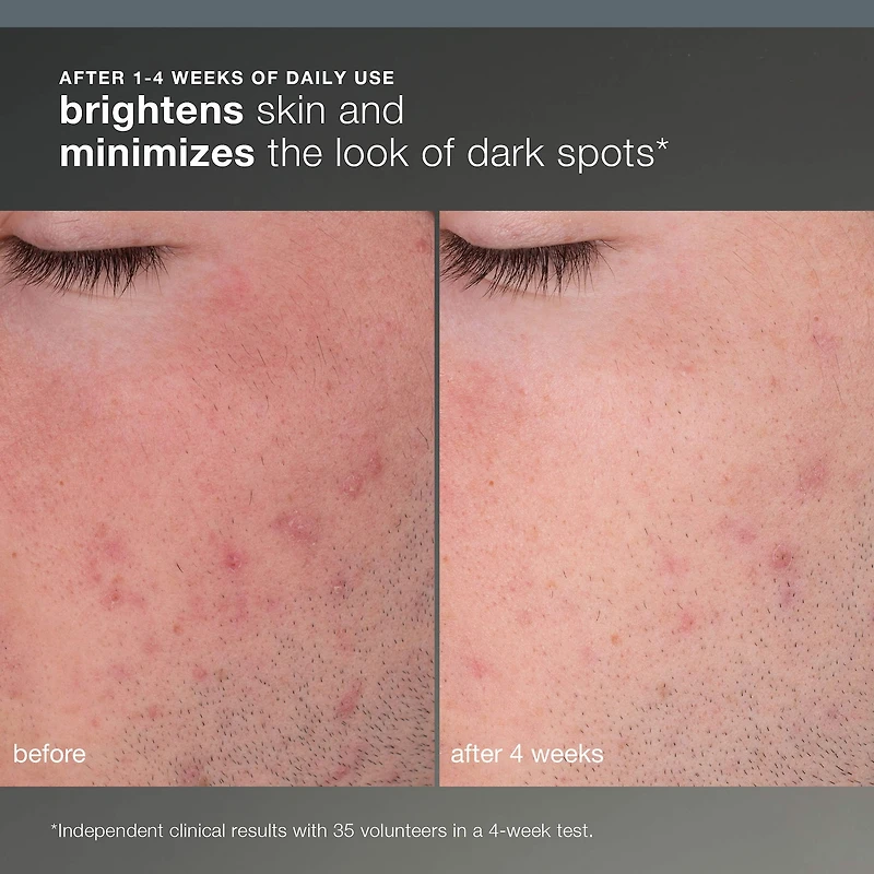 Daily Microfoliant Refillable Exfoliator