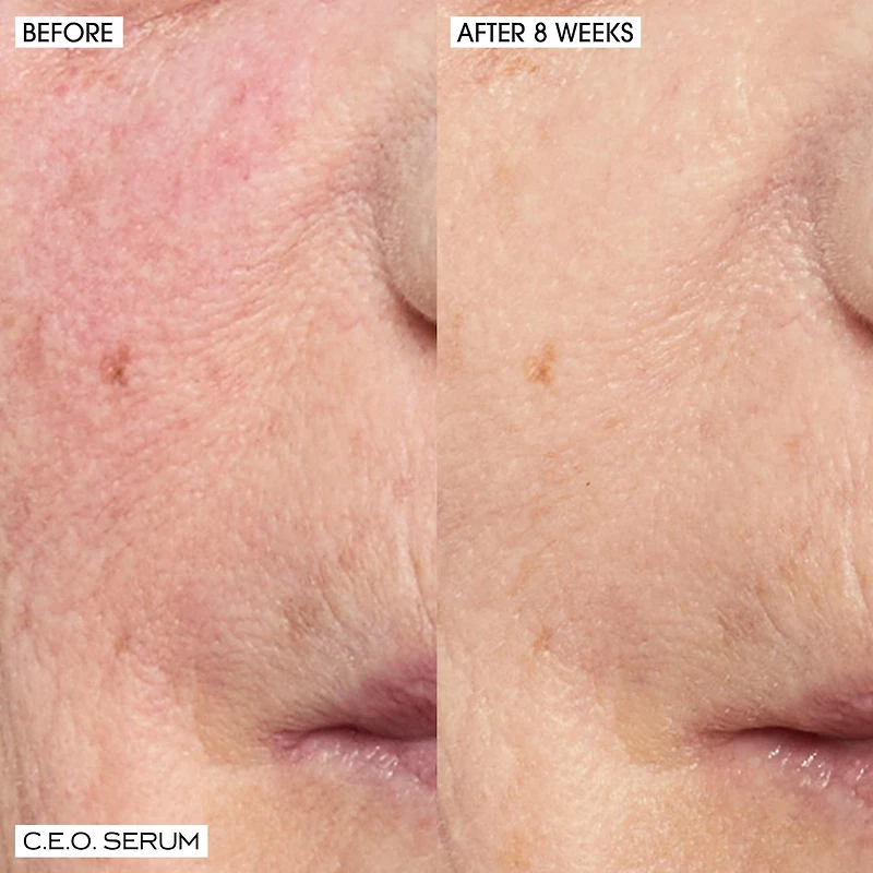 C.E.O. 15% Vitamin C Brightening Serum