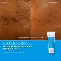 Nettoyant purifiant Clarifying Cleanser à l'acide salicylique