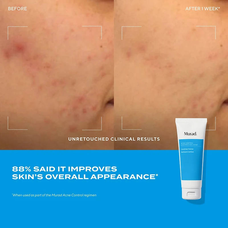 Nettoyant purifiant Clarifying Cleanser à l'acide salicylique