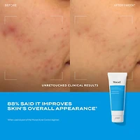 Nettoyant purifiant Clarifying Cleanser à l'acide salicylique