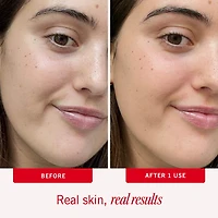 Ultra Repair Face Lotion Daily Hydration with Colloidal Oatmeal 