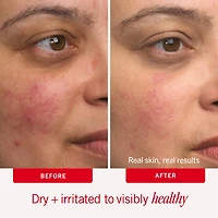 Ultra Repair® Cream Intense Hydration – Face and Body Moisturizer for Skin Repair