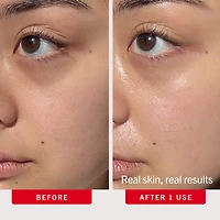 Ultra Repair Hydration Boost Serum with Colloidal Oatmeal + Hyaluronic Acid