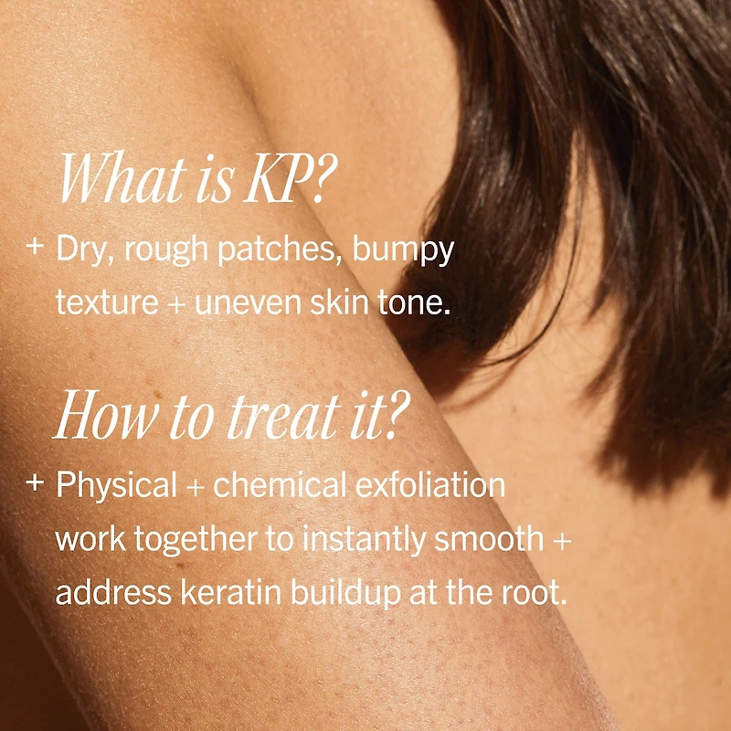 Mini KP Bump Eraser Body Scrub with 10% AHA – Exfoliant for Keratosis Pilaris