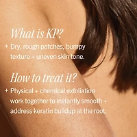 KP Bump Eraser Body Scrub with 10% AHA – Exfoliant for Keratosis Pilaris