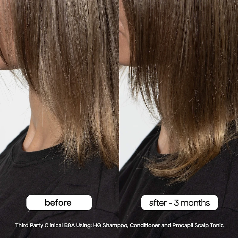 Shampoing HG au romarin pour cheveux clairsemés