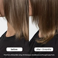 Shampoing HG au romarin pour cheveux clairsemés