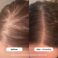 Shampoing HG au romarin pour cheveux clairsemés