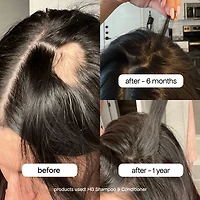 Shampoing HG au romarin pour cheveux clairsemés