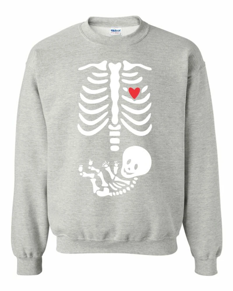 BABY XRAY | T-Shirt Time
