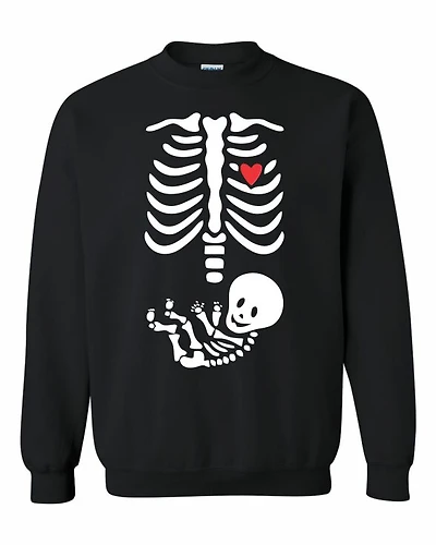BABY XRAY | T-Shirt Time