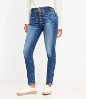 Button Front High Rise Skinny Jeans in Classic Mid Wash